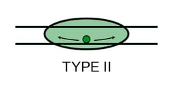 Type-2