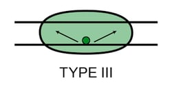 Type-3