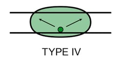 Type-4
